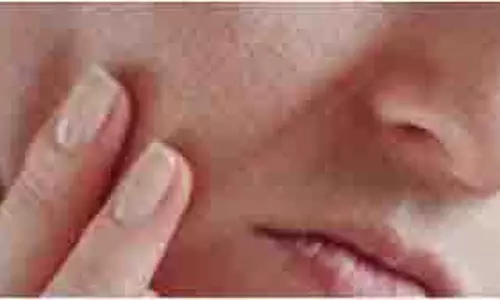 Skine care :गर्मियों में चेहरे पर ज्यादा दिखते हैं ब्लैकहेड्स, अपनाएं ये टिप्स