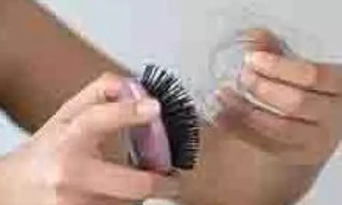 Hair Fall: गर्मियों में इन 4 गलतियों की वजह से झड़ने लगते हैं बाल,जानिए