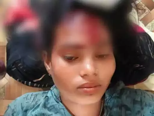 खूंखार जंगली सुअर का हमला, 7 ग्रामीण घायल खूंखार जंगली सुअर का हमला, 7 ग्रामीण घायल