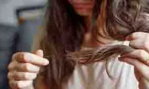 Hair Care : बालों का झड़ना कम करने के लिए अपनाएं ये आसान आयुर्वेदिक उपाय