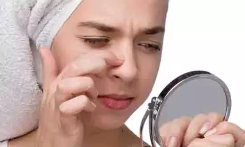 Skin Care:  ब्लैकहेड्स हटाने के 5 घरेलू उपाय