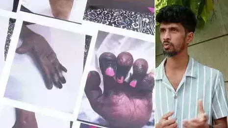 Kerala: सर्जरी में गलती से परिजन नाराज, राज्य समिति तक पहुंचा मामला