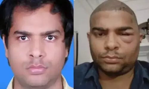 Kanpur: हेयर ट्रांसप्लांट के बाद इंजीनियर की मौत, पुलिस कार्रवाई से परे मामला Kanpur: हेयर ट्रांसप्लांट के बाद इंजीनियर की मौत, पुलिस कार्रवाई से परे मामला
