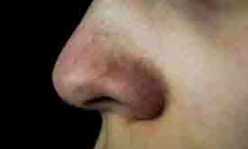 Blackheads Removal Tips: अगर आपकी नाक पर भी हैं ब्लैकहेड्स तो आजमाएं ये आसान तरीका Blackheads Removal Tips: अगर आपकी नाक पर भी हैं ब्लैकहेड्स तो आजमाएं ये आसान तरीका