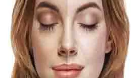 Tanning Remove Tips: गर्मियों में टैनिंग हटाने के लिए इन तरीकों से करें नींबू का इस्तेमाल