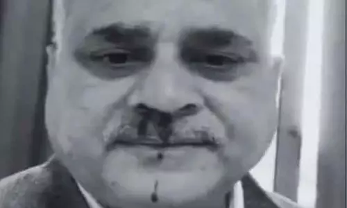 उप कुलपति पर डायरेक्टर ने किया प्राणघातक हमला, पीट-पीटकर किया लहूलुहान