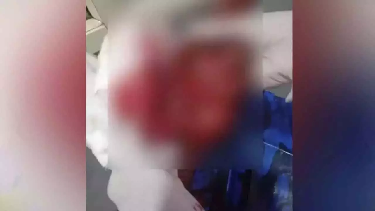 Bantwalके पास चार लोगों के गिरोह ने पेंटर को चाकू घोंपा; पुलिस को व्यक्तिगत दुश्मनी का संदेह Bantwalके पास चार लोगों के गिरोह ने पेंटर को चाकू घोंपा; पुलिस को व्यक्तिगत दुश्मनी का संदेह