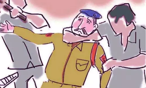 Nawada: कानून के रक्षकों पर हमला, पुलिस टीम घायल