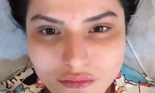 फेशियल एक्यूपंक्चर: चेहरे की चमक बढ़ाने के साथ कई समस्याओं का समाधान है छोटी सी ‘सुई’ फेशियल एक्यूपंक्चर: चेहरे की चमक बढ़ाने के साथ कई समस्याओं का समाधान है छोटी सी ‘सुई’
