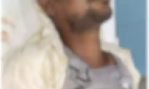 छाती फटा, जेब में मोबाइल था युवक पर गिरी आकाशीय बिजली छाती फटा, जेब में मोबाइल था युवक पर गिरी आकाशीय बिजली