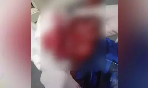 Bantwalके पास चार लोगों के गिरोह ने पेंटर को चाकू घोंपा; पुलिस को व्यक्तिगत दुश्मनी का संदेह Bantwalके पास चार लोगों के गिरोह ने पेंटर को चाकू घोंपा; पुलिस को व्यक्तिगत दुश्मनी का संदेह