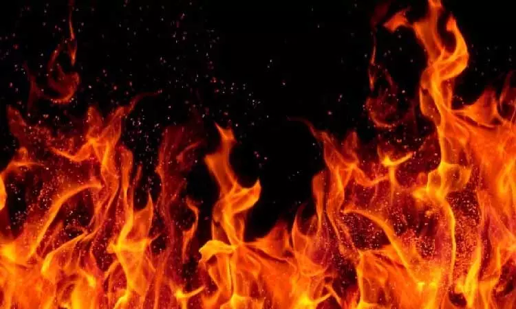 Hyderabad में एक इमारत में आग लगने से 8 लोगों की मौत Hyderabad में एक इमारत में आग लगने से 8 लोगों की मौत