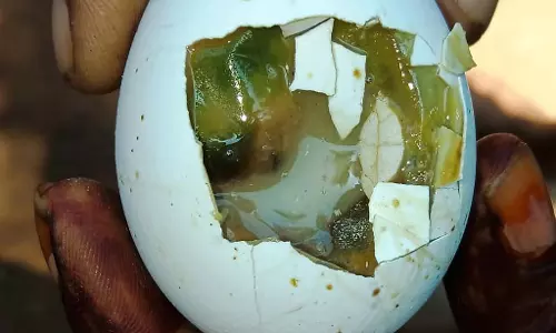 Karnataka : पौष्टिक भोजन वितरण में शिकायतें एवं लापरवाही