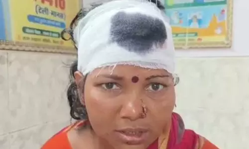 Reel का नशा तो बढ़ता ही जा रहा है...ससुर भड़का, बहू का फोड़ा सिर Reel का नशा तो बढ़ता ही जा रहा है...ससुर भड़का, बहू का फोड़ा सिर
