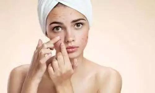 Beauty Care: डार्क स्पॉट्स की वजह से आपका चेहरा दिखता है  खराब , तो आजमाएं ये घरेलू उपाय