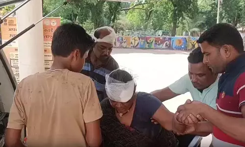 दो परिवार पुरानी रंजिश पर भिड़े, महिला समेत 3 लोग घायल दो परिवार पुरानी रंजिश पर भिड़े, महिला समेत 3 लोग घायल