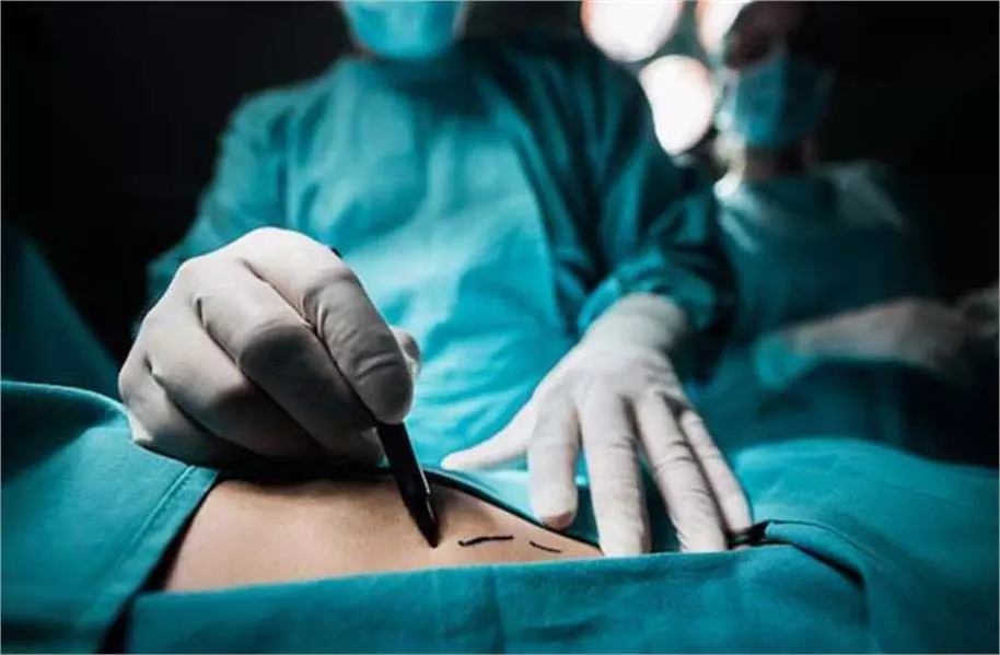 Jammu-Kashmir: 55 वर्षीय महिला के शरीर से निकाला गया 7 किलो का ट्यूमर, जानें कैसे हुई सफल सर्जरी Jammu-Kashmir: 55 वर्षीय महिला के शरीर से निकाला गया 7 किलो का ट्यूमर, जानें कैसे हुई सफल सर्जरी