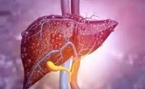 Health: कितना खतरनाक है लिवर ट्यूमर, जिसने पॉपुलर टीवी एक्ट्रेस दीपिका कक्कड़ को बनाया शिकार Health: कितना खतरनाक है लिवर ट्यूमर, जिसने पॉपुलर टीवी एक्ट्रेस दीपिका कक्कड़ को बनाया शिकार