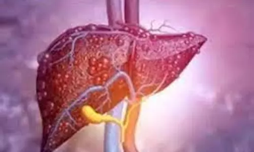 Health: कितना खतरनाक है लिवर ट्यूमर, जिसने पॉपुलर टीवी एक्ट्रेस दीपिका कक्कड़ को बनाया शिकार