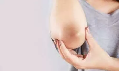 Skin care: कोहनी और घुटने को साफ़ करने के घरेलु नुस्खे Skin care: कोहनी और घुटने को साफ़ करने के घरेलु नुस्खे