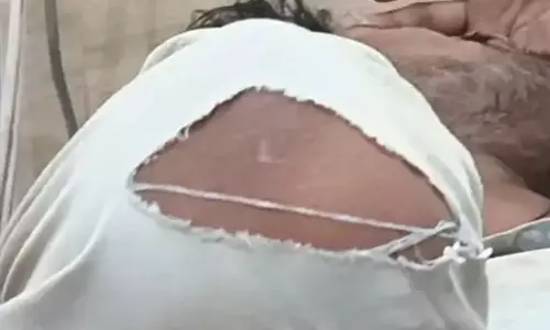 मोबाइल गुमने पर भाइयों के बीच हुई मारपीट, एक गंभीर रूप से घायल