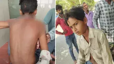 Lakhimpur Kheri: खेत पर किशोर पर तेंदुए का हमला