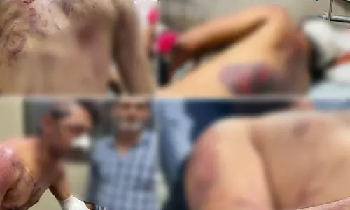 रास्ता रोककर गाड़ी में तोड़फोड़ और 4 लोगों पर भीड़ ने किया हमला, सभी गंभीर रूप से घायल