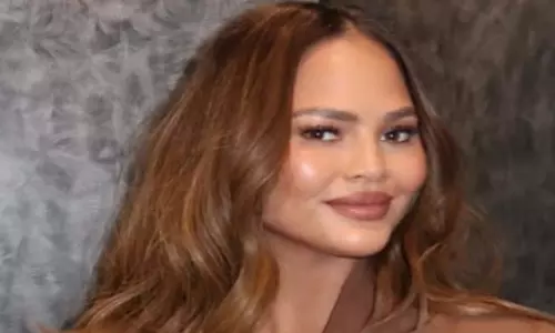 Chrissy Teigen ने अपनी नवीनतम कॉस्मेटिक प्रक्रिया का खुलासा किया