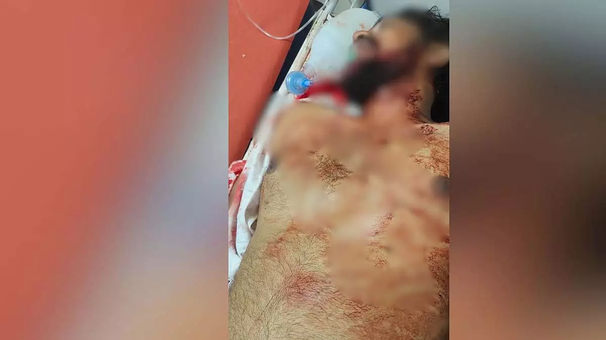 घाटकोपर रोड रेज की घटना में कार डीलर की चाकू घोंपकर हत्या; आरोपी बाइकर की तलाश जारी घाटकोपर रोड रेज की घटना में कार डीलर की चाकू घोंपकर हत्या; आरोपी बाइकर की तलाश जारी