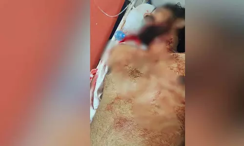 घाटकोपर रोड रेज की घटना में कार डीलर की चाकू घोंपकर हत्या; आरोपी बाइकर की तलाश जारी
