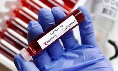 Karnataka: 80 एक्टिव केस में 73 सिर्फ बेंगलुरु में पाए गए
