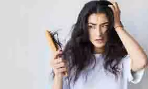 Hair Care: गर्मियों में बाल झड़ने से हैं परेशान? तो अपनाएं ये आसान टिप्स Hair Care: गर्मियों में बाल झड़ने से हैं परेशान? तो अपनाएं ये आसान टिप्स
