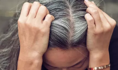 White Hair Remedy: कम उम्र में सफेद बालों की समस्या से हैं परेशान तो जरूर आजमाएं ये उपाय