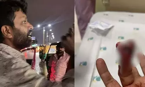 Bengaluru : कार में बारिश का पानी घुसने से नाराज ड्राइवर ने एक व्यक्ति की उंगली काट ली