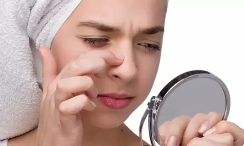 Beauty Tips:  ब्लैकहेड्स हटाने के 5 घरेलु उपाय