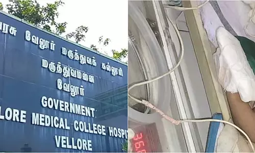 Tamil Nadu : सरकारी अस्पताल में नर्स ने बच्चे का अंगूठा काटा