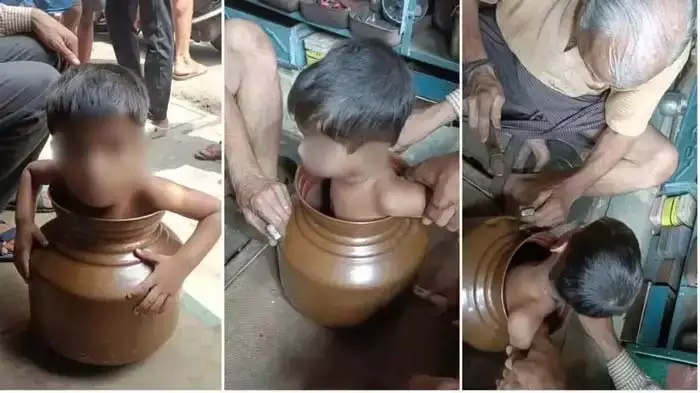 गगरी में फंसा बच्चा, परिवार पर भारी संकट गगरी में फंसा बच्चा, परिवार पर भारी संकट