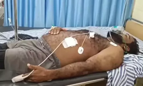 वडकारा में CPM कार्यकर्ताओं पर चाकू से हमला