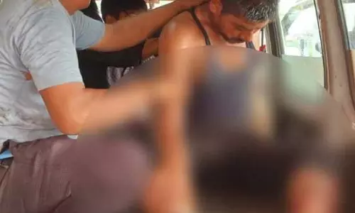 ठेका श्रमिक के दोनों पैर जले, ट्रांसफार्मर सुधारते वक्त दौड़ा करंट ठेका श्रमिक के दोनों पैर जले, ट्रांसफार्मर सुधारते वक्त दौड़ा करंट