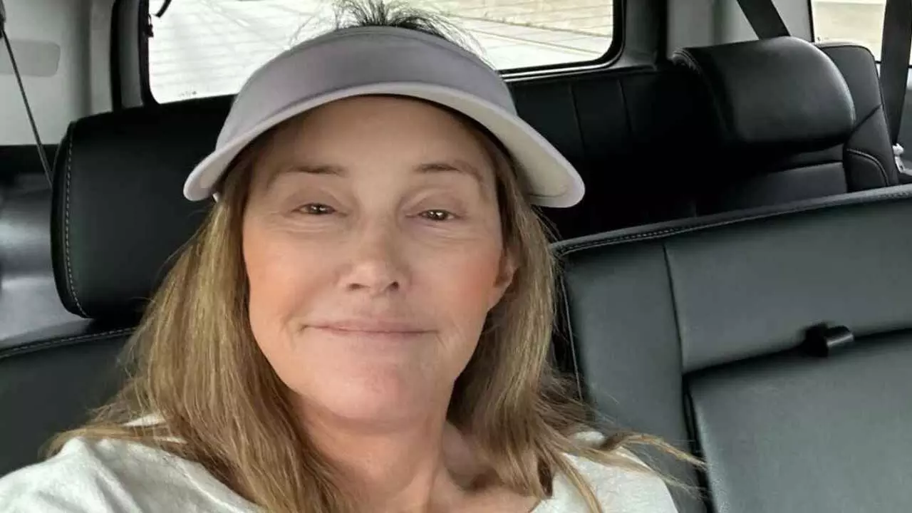 Caitlyn Jenner ने काइली जेनर और टिमोथी चालमेट के रिश्ते को मंजूरी दी Caitlyn Jenner ने काइली जेनर और टिमोथी चालमेट के रिश्ते को मंजूरी दी