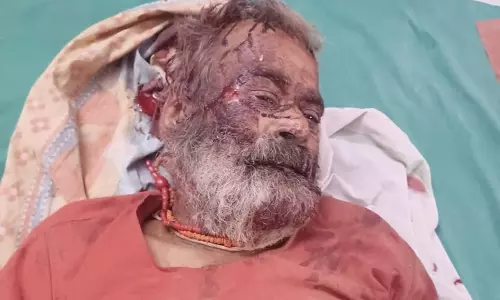 Kampil: मंदिर में चोरी करने आए युवक ने महंत पर किया आक्रमण Kampil: मंदिर में चोरी करने आए युवक ने महंत पर किया आक्रमण