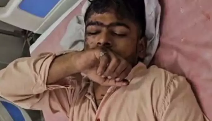 BSNL कर्मी पर हमला कर लूटपाट, सिम्स में इलाज जारी BSNL कर्मी पर हमला कर लूटपाट, सिम्स में इलाज जारी