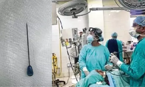 Indore : डॉक्टरों ने किशोरी के पेट से 7 सेमी लंबा पिन निकाला Indore : डॉक्टरों ने किशोरी के पेट से 7 सेमी लंबा पिन निकाला