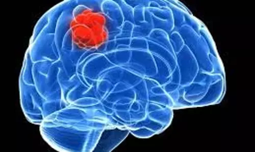 Brain Tumor: क्या हैं ब्रेन ट्यूमर के शुरुआती लक्षण, कैसे करें इसकी पहचान