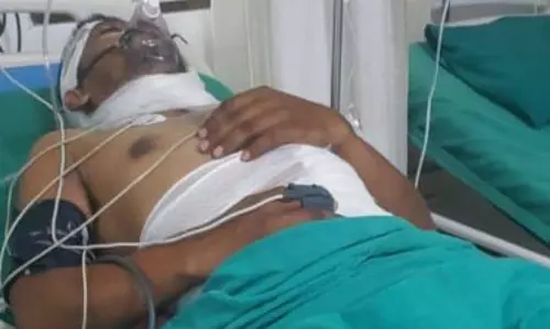 ट्रांसफार्मर सुधारते वक्त ठेका श्रमिक को लगा झटका, इलाज के दौरान मौत ट्रांसफार्मर सुधारते वक्त ठेका श्रमिक को लगा झटका, इलाज के दौरान मौत