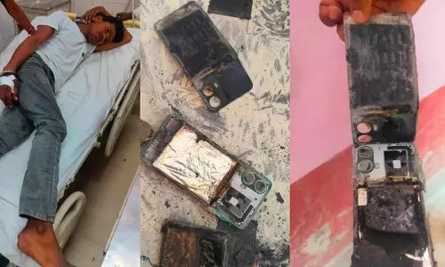 Barabanki: अस्पताल में मरीज के पैंट में फोन फटने से दहशत