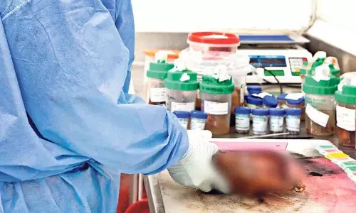 Hyderabad में छह खाद्य परीक्षण प्रयोगशालाएं स्थापित की जाएंगी
