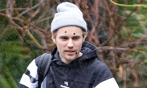 Justin Bieber ने घुटने की चोट पर चिंता जताई, हैली के प्रति ‘बुरी’ टिप्पणी की Justin Bieber ने घुटने की चोट पर चिंता जताई, हैली के प्रति ‘बुरी’ टिप्पणी की
