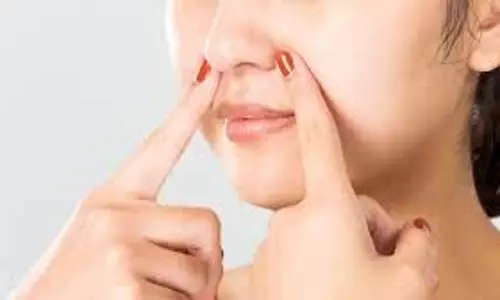 Skin Care: नाक और ठुड्डी पर दिखने वाले ब्लैकहेड्स से हैं परेशान, तो आजमाएं ये घरेलू उपाय Skin Care: नाक और ठुड्डी पर दिखने वाले ब्लैकहेड्स से हैं परेशान, तो आजमाएं ये घरेलू उपाय