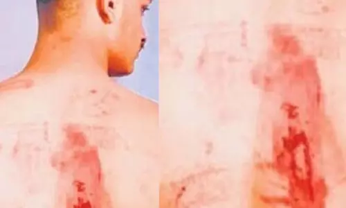 डिलीवरी ब्वॉय के साथ अमानवीय कृत्य, बदमाशों ने चेहरे पर किया पेशाब